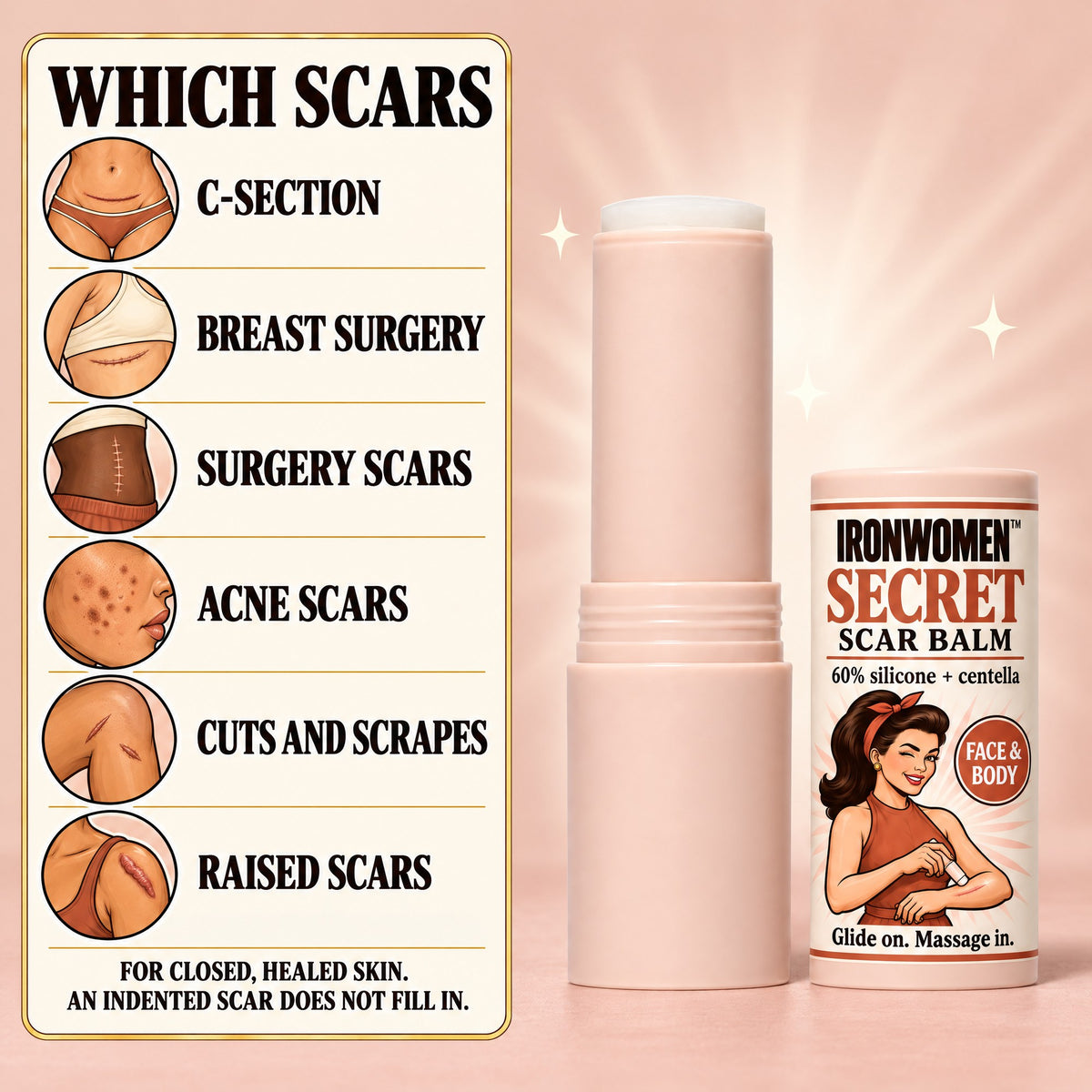 Which scars: C-section, breast surgery, surgery scars, acne scars, cuts and scrapes, raised scars